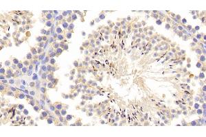 Detection of MMP1 in Mouse Testis Tissue using Polyclonal Antibody to Matrix Metalloproteinase 1 (MMP1) (MMP1 抗体  (AA 98-275))