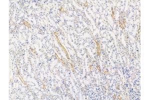 ABIN7094642 and ABIN7098692 at 1/100 staining Rat kidney tissue by IHC-P. (DNAH1 抗体  (Internal Region))