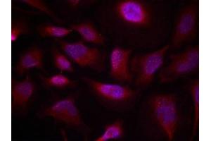 Immunofluorescence staining of methanol-fixed Hela cells using ATF2(Phospho-Thr73 or 55) Antibody. (ATF2 抗体  (pThr73))