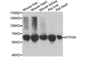 Western blot analysis of extracts of various cell lines, using ETFDH antibody. (ETFDH 抗体  (AA 318-617))