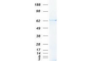 Western Blotting (WB) image for Abl-Interactor 1 (ABI1) (Transcript Variant 1) protein (Myc-DYKDDDDK Tag) (ABIN2714283)