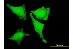 Immunofluorescence of monoclonal antibody to LMO3 on HeLa cell. (LMO3 抗体  (AA 91-146))