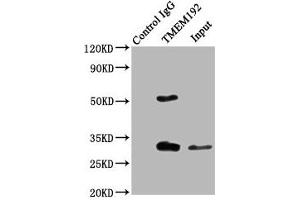 Immunoprecipitating TMEM192 in Jurkat whole cell lysate Lane 1: Rabbit control IgG (1 μg) instead of ABIN7173123 in Jurkat whole cell lysate. (TMEM192 抗体  (AA 193-271))