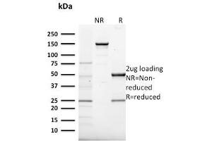 SDS-PAGE (SDS) image for anti-Frataxin (FXN) (AA 57-210) antibody (ABIN6939442)