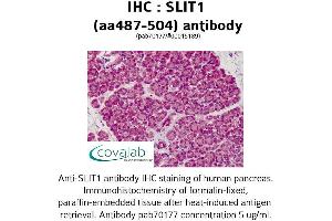 Image no. 1 for anti-Slit Homolog 1 (SLIT1) (AA 487-504) antibody (ABIN1739431) (SLIT1 抗体  (AA 487-504))