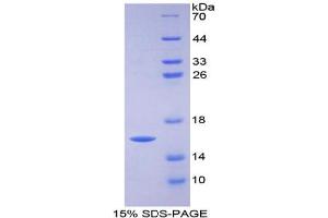 SDS-PAGE analysis of Human FABP3 Protein. (FABP3 蛋白)