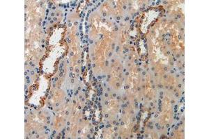Used in DAB staining on fromalin fixed paraffin- embedded kidney tissue (IGFBP6 抗体  (AA 31-240))