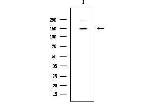 anti-RBP1-like protein (ARID4B) (C-Term) antibody