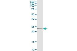 Immunoprecipitation of FKBP11 transfected lysate using anti-FKBP11 MaxPab rabbit polyclonal antibody and Protein A Magnetic Bead , and immunoblotted with FKBP11 purified MaxPab mouse polyclonal antibody (B01P) . (FKBP11 抗体  (AA 1-201))