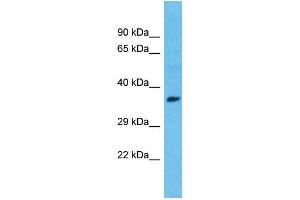 Host:  Rabbit  Target Name:  ISL1  Sample Type:  Breast Tumor lysates  Antibody Dilution:  1. (ISL1 抗体  (C-Term))