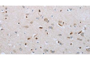 Immunohistochemistry of paraffin-embedded Human brain tissue using FGF1 Polyclonal Antibody at dilution 1:50 (FGF1 抗体)