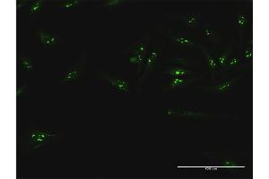 Immunofluorescence of purified MaxPab antibody to UTP18 on HeLa cell. (UTP18 抗体  (AA 1-521))