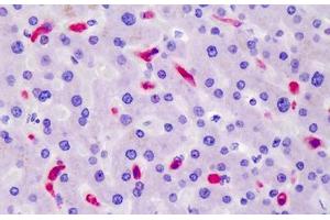 Human Liver: Formalin-Fixed, Paraffin-Embedded (FFPE) (CD163 抗体)