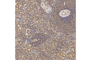 IHC analysis of TST using anti-TST antibody (ABIN7599105). (TST 抗体  (AA 1-220))