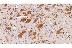 Detection of Flt3L in Mouse Cerebrum Tissue using Polyclonal Antibody to FMS Like Tyrosine Kinase 3 Ligand (Flt3L) (FLT3LG 抗体  (AA 27-189))