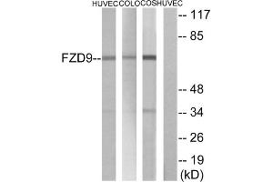 Western blot analysis of extracts from HUVEC cells COLO cells and COS cells, using FZD9 antibody. (FZD9 抗体  (C-Term))