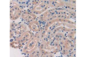 Used in DAB staining on fromalin fixed paraffin- embedded kidney tissue (TSTA3 抗体  (AA 1-321))