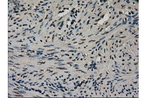 Immunohistochemical staining of paraffin-embedded Ovary tissue using anti-CTAG1Bmouse monoclonal antibody. (CTAG1B 抗体)