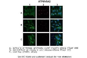 Application: IHC/Immunofluorescence Species+tissue/cell type:A. (ATP6V0A2 抗体  (N-Term))