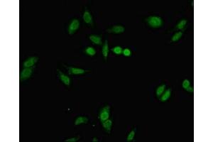 Immunofluorescent analysis of Hela cells using ABIN7152677 at dilution of 1:100 and Alexa Fluor 488-congugated AffiniPure Goat Anti-Rabbit IgG(H+L) (FERD3L 抗体  (AA 1-167))