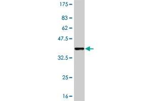 Western Blot detection against Immunogen (36. (PKNOX1 抗体  (AA 2-100))