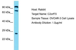 Host: Rabbit Target Name: C2ORF70 Sample Tissue: Human OVCAR-3 Whole Cell Antibody Dilution: 1ug/ml (C2ORF70 抗体  (C-Term))