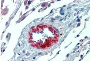 Lung, vasculature, Human: Formalin-Fixed, Paraffin-Embedded (FFPE) (IL23A 抗体)