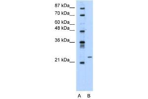 Transfected 293T; WB Suggested Anti-PMF1 Antibody Titration: 0. (PMF1 抗体  (Middle Region))