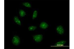Immunofluorescence of purified MaxPab rabbit antibody to IL16 on HeLa cell. (IL16 抗体  (AA 1-454))