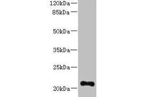 Western blot All lanes: TTC9C antibody at 12 μg/mL + THP-1 whole cell lysate Secondary Goat polyclonal to rabbit IgG at 1/10000 dilution Predicted band size: 21, 25 kDa Observed band size: 21 kDa (TTC9C 抗体  (AA 1-171))