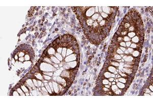 ABIN6272883 at 1/100 staining Mouse colon tissue by IHC-P. (TMEM67 抗体  (Internal Region))