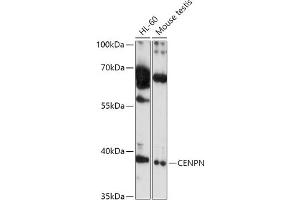 Western blot analysis of extracts of various cell lines, using CENPN antibody (ABIN7266276) at 1:1000 dilution. (CENPN 抗体  (AA 180-300))