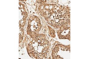 (ABIN392786 and ABIN2842224) staining PFKFB4 in human testis tissue sections by Immunohistochemistry (IHC-P - paraformaldehyde-fixed, paraffin-embedded sections). (PFKFB4 抗体  (AA 266-296))
