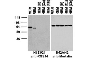 Immunoblot against crude membranes from whole mouse (MBM) or rat (RBM) brain and from human hippocampus [HBM(H)], cerebral cortex [HBM(Cx)] or cerebellum [HBM(Cb)] probed with N133/21 (left) or N52A/42 (right) TC supe. (RGS14 抗体  (AA 1-544))
