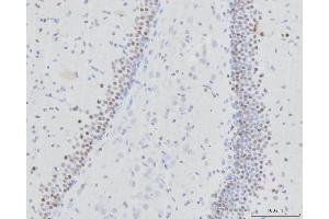 IHC analysis of RFX3 using anti-RFX3 antibody (ABIN7601095).