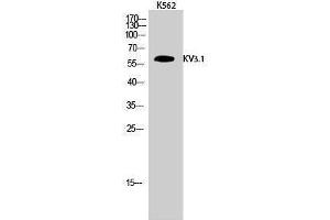 Western Blotting (WB) image for anti-Potassium Voltage-Gated Channel, Shaw-Related Subfamily, Member 1 (KCNC1) (Internal Region) antibody (ABIN3185333) (KCNC1 抗体  (Internal Region))