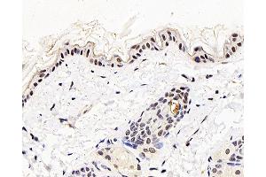 Immunohistochemistry analysis of paraffin-embedded mouse skin using MGMT Polyclonal Antibody at dilution of 1:300. (MGMT 抗体)