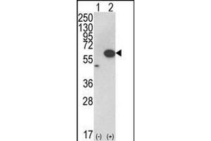 Western blot analysis of AKT1 (arrow) using rabbit polyclonal hAKT1- (ABIN652283 and ABIN2841190). (AKT1 抗体  (C-Term))