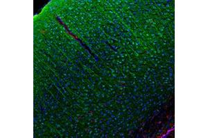 Image no. 1 for anti-Chemokine (C-C Motif) Ligand 5 (CCL5) antibody (ABIN465616) (CCL5 抗体)