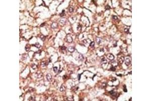 Immunohistochemistry (IHC) image for anti-STIP1 Homology and U-Box Containing Protein 1 (STUB1) (AA 203-231) antibody (ABIN3032755)