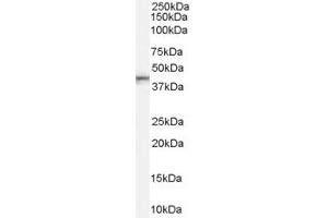 Image no. 5 for anti-Asporin (ASPN) (Internal Region) antibody (ABIN185364)