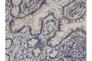 Immunoperoxidase of monoclonal antibody to KIF1C on formalin-fixed paraffin-embedded human small Intestine. (KIF1C 抗体  (AA 1004-1103))