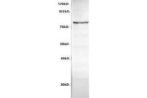 Western Blot analysis of HeLa cells using Cadherin-8 Polyclonal Antibody at dilution of 1:600 (Cadherin 8 抗体)