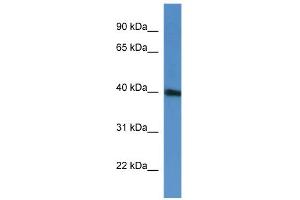 Western Blotting (WB) image for anti-PRP38 Pre-mRNA Processing Factor 38 (Yeast) Domain Containing A (PRPF38A) (C-Term) antibody (ABIN2774293)