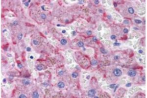 Human Liver: Formalin-Fixed, Paraffin-Embedded (FFPE) (SORBS1 抗体  (AA 300-313))