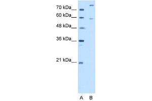 WB Suggested Anti-CROT Antibody Titration:  2. (CROT 抗体  (N-Term))
