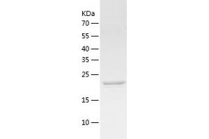 Oncostatin M (OSM) (AA 26-239) protein (His tag)