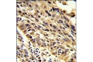 Immunohistochemistry (Paraffin-embedded Sections) (IHC (p)) image for anti-Thyroid Hormone Receptor Interactor 13 (TRIP13) (AA 64-90), (N-Term) antibody (ABIN389357)
