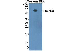 Western blot analysis of the recombinant protein. (FOXP3 抗体  (AA 190-412))