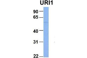 Host:  Rabbit  Target Name:  URI1  Sample Type:  MCF7  Antibody Dilution:  1. (URI1 抗体  (Middle Region))
